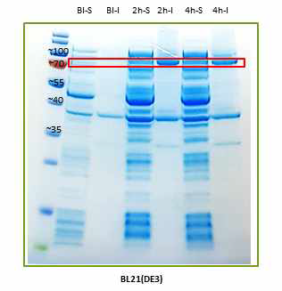 BL21(DE3)pLysS 발현 단백질 분석