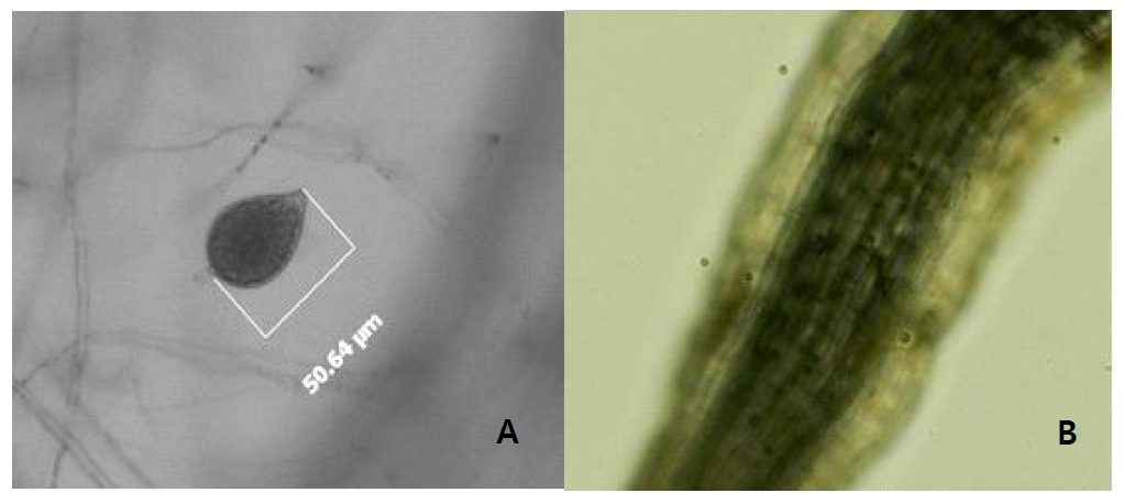 Sporangium of Phytophthora blight pathogen (Phytophthora nicotianae)(A), zoospores surrounding the root hair of sesame(B)