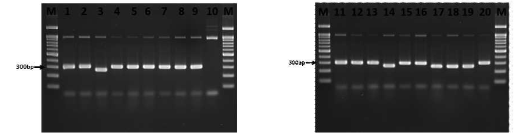 Neuropeptide Y 2 receptor 결합 앱타머 서열 확인을 위한 Colony PCR 결과 (1-20번)