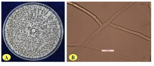 Morphological characteristics of S. minor from diseased Aster yomena. A, black small sclerotia on PDA incubated at 20℃ for 20 days; B, hyphae of S. minor by light microscope