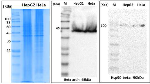 Hsp90-beta W/B 결과