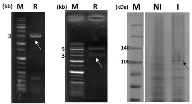 EV 제작 위한 PCR(왼), Sub-cloning(중간), 단백질발현 결과(우)