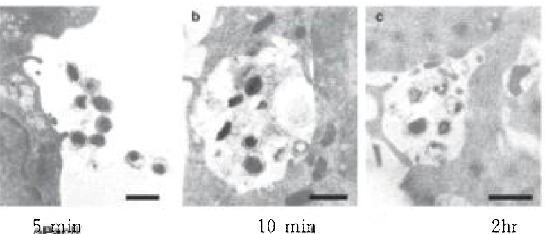 TEM으로 분석한 세포 내에서의 미니세포 약물전달 과정