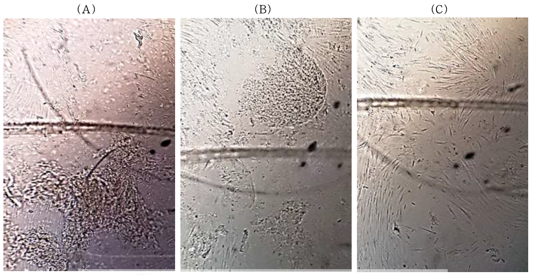 (A)DMEM을 교체한 직후 세포 사진(with endosome from egg) (B)DMEM을 교체한 후 19시간이 지났을 때 세포 사진(with endosome from egg) (C)DMEM을 교체한 후 23시간이 지났을 때 세포 사진(with endosome from egg)