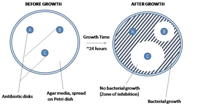 zone of inhibition test 방법에 대한 모식도