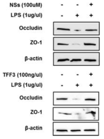 Intestinal barrier function관련 유전자 및 단백질의 발현 양상