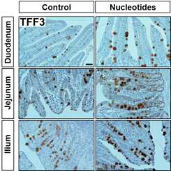 TFF3 유전자의 발현 양상