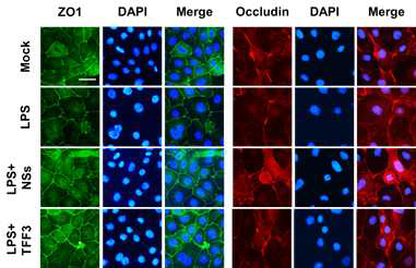 Intestinal barrier function관련 유전자인 ZO-1 및 Occludin의 발현양상을 검증