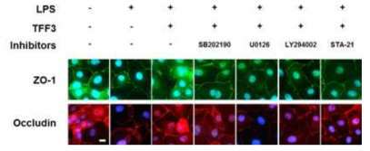 signaling pathway (AKT, P38, STAT, ERK1/2)와 관련된 유전자의 발현 양상을 분석