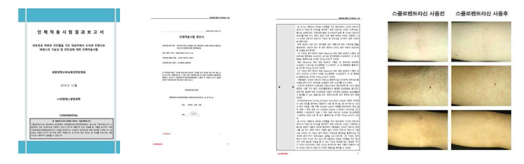 아토피성 피부염 환자에 대한 스콜로펜드라신1 함유 오아센 스킨큐어의 임상시험