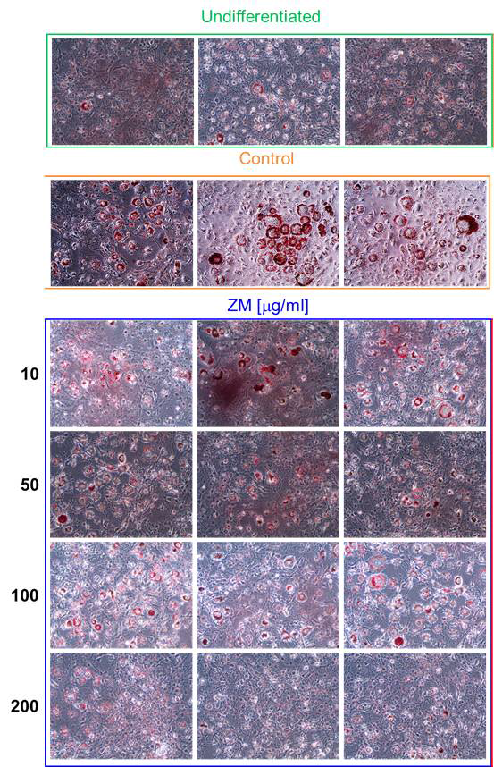 아메리카왕거저리 에탄올 추출물(ZM)에 대한 지방세포 분화 억제 효과 시험