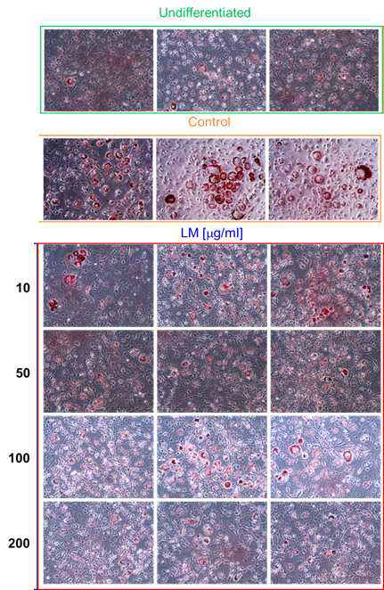 풀무치 에탄올 추출물(LM)에 대한 지방세포 분화 억제 효과 시험