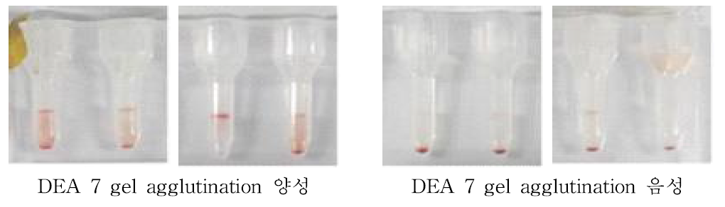 Gel column agglutination 방법을 활용한 혈액형 판정법