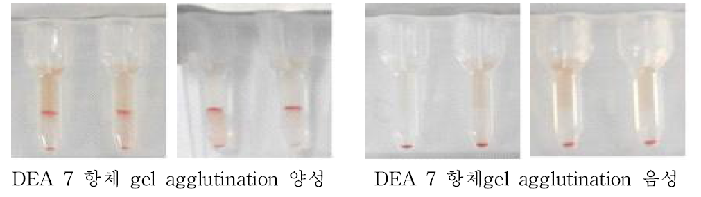 Gel column agglutination 방법을 활용한 DEA 7 자연발생 항체 판정