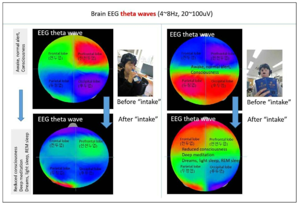 미강추출액 섭취 전후 EEG theta “얕은 수면” 상태의 4-8 hz 파형