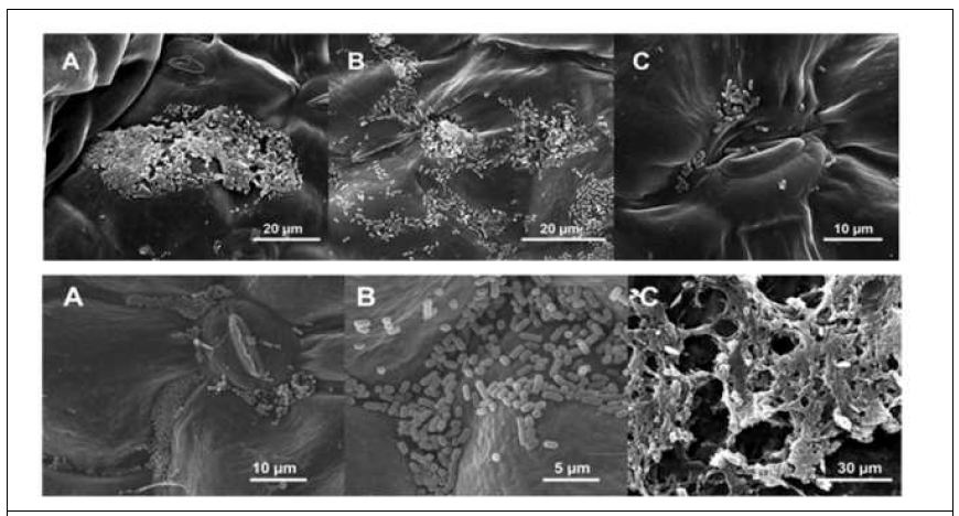 파리 토사물에 의한 시금치 표면의 E. coli O157:H7 주사전자현미경 이미지 (상: 파리 토사물에 의한 시금치 표면의 E. coli O157:H7, 하: 인위적으로 접종한 E. coli O157:H7)