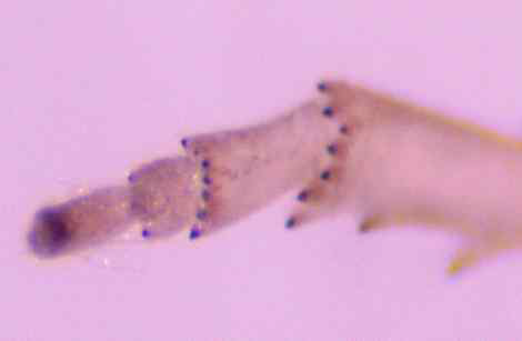 Metathoracic legs of 5th M. pruinosa instar