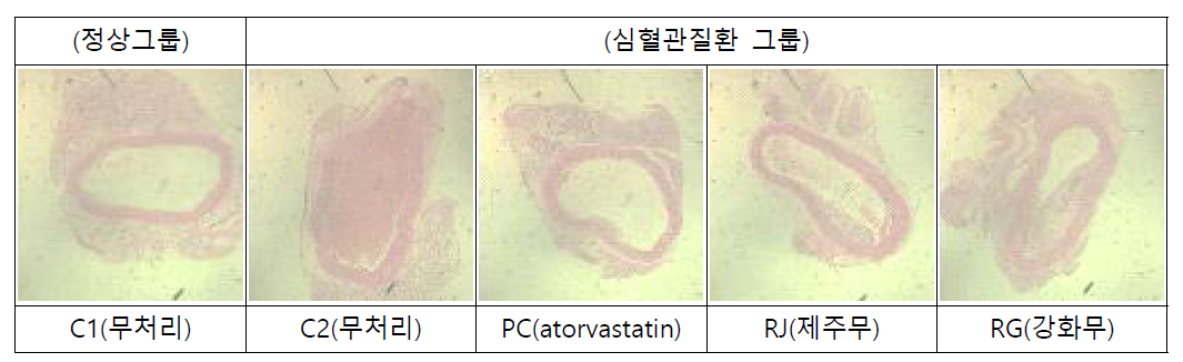 무 추출물의 혈관 조직 내 반(plaque) 형성 억제 평가