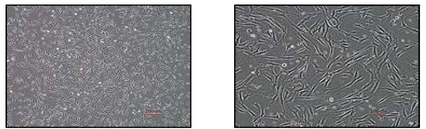 Morphology of adipose derived mesenchymal stem cells(A-MSCs) at passage 0 (20X, 100X)