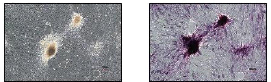 Analysis of Alkaline Phosphatase(AP) Staining. A-MSCs positive AP Staining