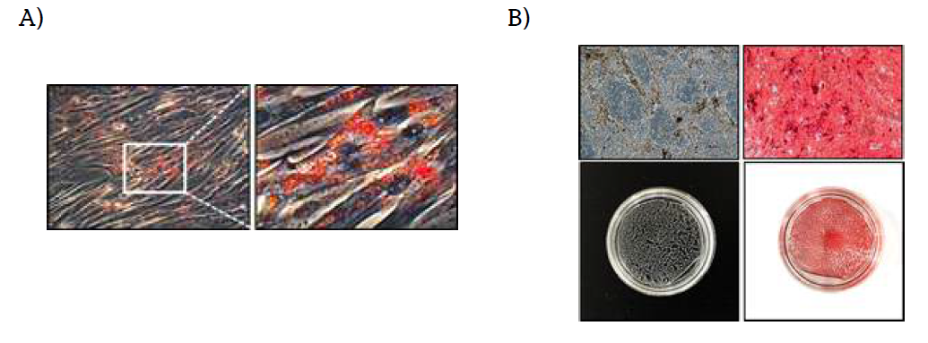 Adipogenic potential of A-MSCs was estimated with positive Oil Red O staining after 21days in induction medium (A). Osteogenic potential of A-MSCs was estimated with positive Alizarin Red S staining after 21days in in duction medium (B)