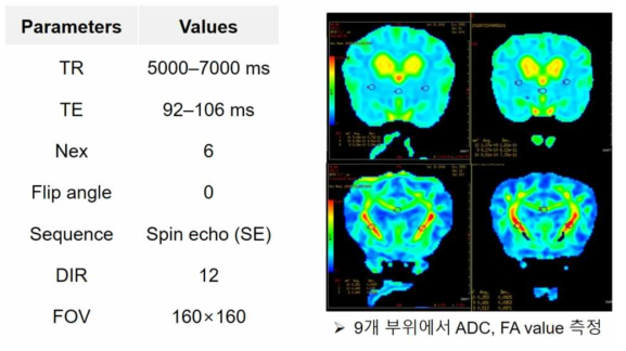 본 연구에서 확립된 DTI 촬영 조건 및 적용 예시