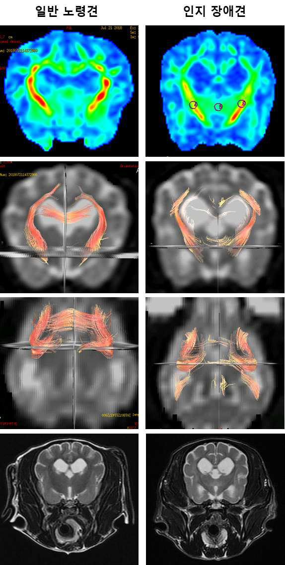 그룹 3 내, 동일 연령 (13Y)에서 일반 노령견 (좌) 및 인지 장애견(우) 의 DTI FA 값, Tractography 의 비교. 두 개체 모두 노령견임에도 불구하고, 해부학적 뇌 부피의 감소, 명확한 FA 신호의 감소 및 신경 섬유의 감소가 확인