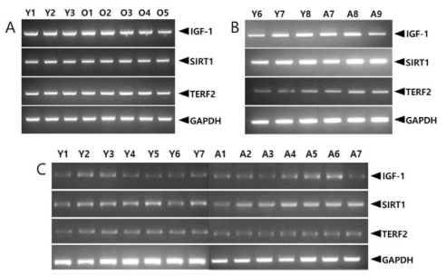 RT-PCR analyses of young and older dogs. A, PCR analyses of young (Y1, Y2, Y3) and older (O1 ∼ O5) small dogs. B, PCR analyses of young (Y6, Y7, Y8) and older (A7, A8, A9) medium dogs. C, PCR analyses of young (Y1 ∼Y7) and older (A1 ∼ A7) large dogs