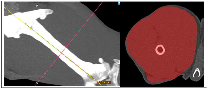 CT를 이용한 근육량 측정. 대퇴골의 정중점을 측정하여 (좌), 해당 부위에서는 가로 단면에서 근육량을 측정한다 (우)