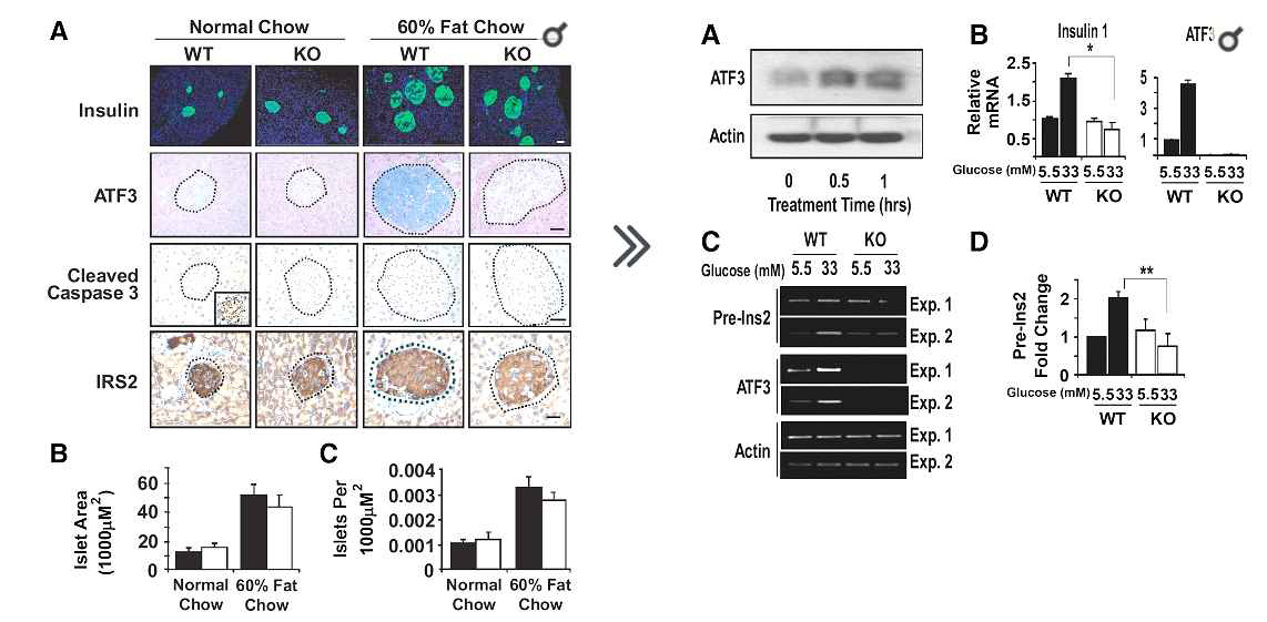 ATF3과 인슐린 gene 발현 연관성 *출처 : Zmuda et al., The Roles of ATF3, an Adaptive-Response Gene, in High – Fat – Diet - Induced Diabetes and Pancreatic β-Cell Dysfunction, Mol Endocrinol, 2010