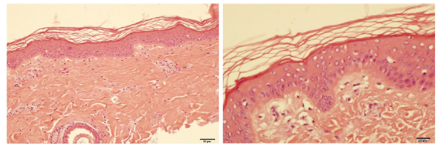 시험에 사용된 마이크로피그 피부 조직(H&E 염색，좌X100 , 우X 200)