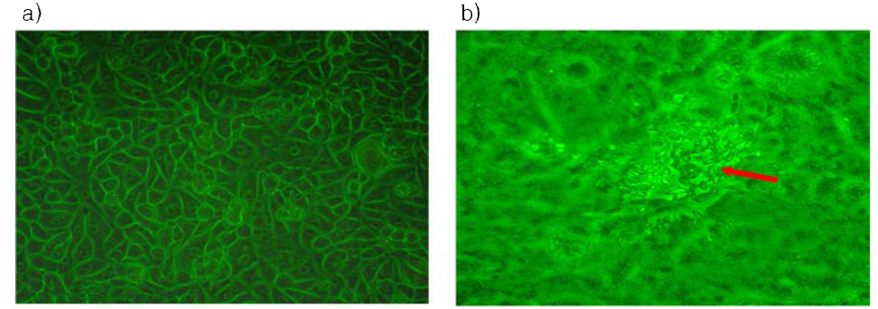 Toxoplasma gondii 표준균주의 세포 내 배양 결과 (a) Vero cell 내 T. gondii 감염 초기，(b) T. gondii tachyzoites가 Vero cell에서 나와 증식하고 있는 모습