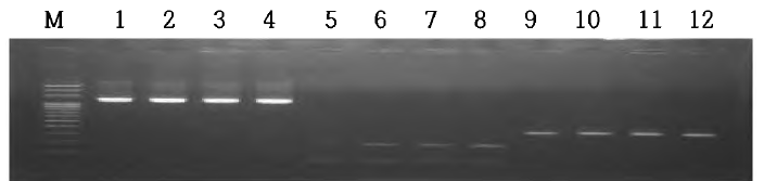 C. difficile 독소 유전자 검출을 위한 PCR 결과. Lanes: M, 100 bp plus ladder; 1-3, positive samples (tcd A); 4, tcd A positive control (1266 bp); 5-7, positive samples (tcd B); 4, tcd B positive control (204 bp); 9-11, binary toxin positive samples; 12, binary toxin positive control (375 bp)