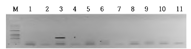 와포자충 nested PCR 전기영동 결과 The expected size of amplicon was 587 bp. Lanes: M, 100 bp plus ladder; 3, a positive sample; and the others, negative samples