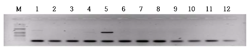 섬모충(Balantidium coli) nested PCR 전기영동 결과. The expected size of amplicon was at 1,047 bp. Lanes: M, 100 bp plus ladder; 5, a positive sample; and others, negative samples