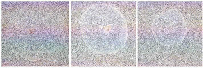 돼지 배아줄기세포 및 유도만능줄기세포 모양