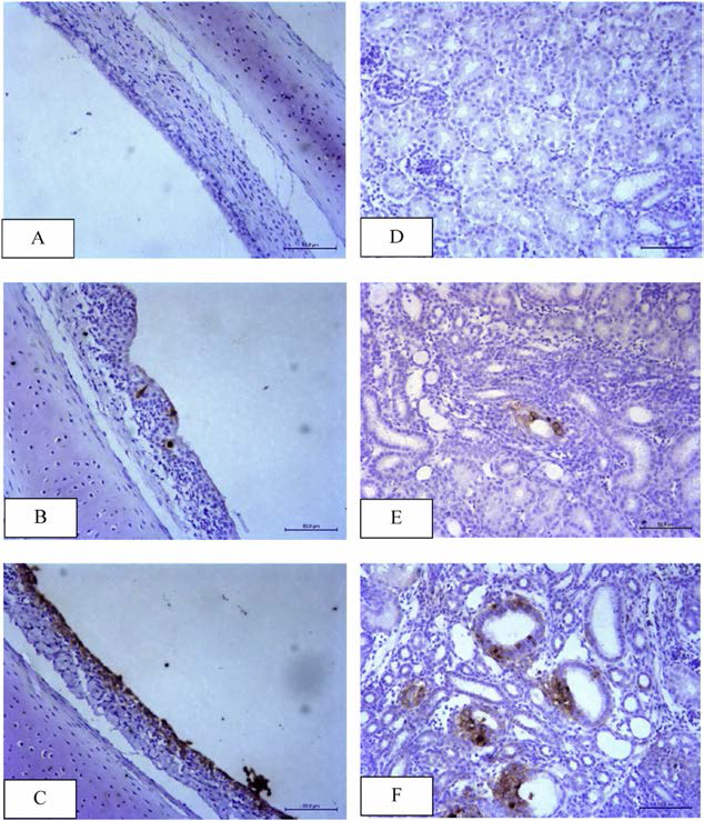 Immunohistochemistry of trachea and kidney in SPF chickens infected with IBV isolate at 4 days post inoculation: (A and D) No viral antigens in tracheal and renal epithelial cells in SPF chickens at 4 days post inoculation (pi)； (B and C) Viral antigens in the mucosal epithelium； hyperplastic epithelial cells and infiltration of lymphoid cells in the tracheal submucosa at 4 days pi in SPF chickens infected with Malaysian QX-like strain IBS130/2015 and variant strain IBS037A/2014 respectively； (E and F) Viral antigens in the epithelial cells of the renal tubular epithelial cells at 4 days pi in SPF chickens infected with Malaysian variant strain and QX-like strain, respectively. IHC, x20