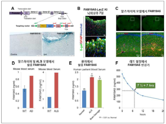 각 질환별 동물모델 및 신경손상 환자에서 FAM19A5의 발현 증가 (unpublished data)