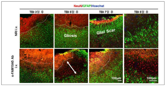 FAM19A5 항체 처리에 의한 신경교증식증 억제 (뇌외상 모델) (unpublished data)