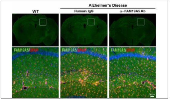 FAM19A5 항체 처리에 의한 신경교증식증 억제 (알츠하이머 모델)