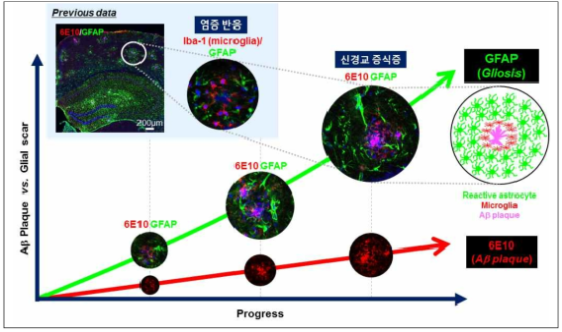 알츠하이머 질환에서 아밀로이드 플라크, 염증반응, 신경교증식증