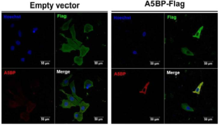 empty vector 혹은 A5BP 세포 내 발현 양상