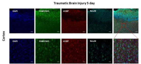 뇌손상 모델에서의 FAM19A5 수용체 발현 양상