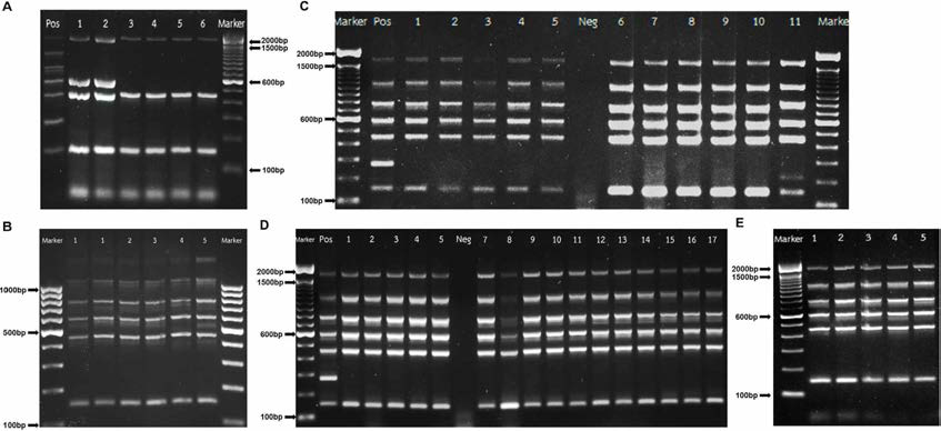 Multiplex-PCR을 이용한 태국 동물유래 1~7차 분리주의 Brucella species 감별결과(태국 측) Lane M; 100bp DNA ladder, A, 1~5th B. abortus isolates from beef cattle and daily cattle, B -E, 1~7th B. melitensis isolates from goats and sheep in Lop Buri, Uttaradit, Ratchaburi, Nonthaburi, Sa Kaeo, Nakhonratchasima