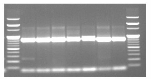 VP1 65 °C 의 DNA 클론인 Plasmid DNA의 PCR 증폭산물