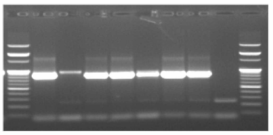 VP1 90°C의 DNA 클론인 Plasmid DNA의 PCR 증폭산물