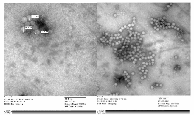 인공감염 꿀벌 유충 내 Korean Sacbrood virus (KSBV)의 Transmission electron microscopy 촬영사진