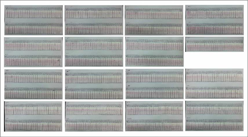 FMDV 단클론항체 31종을 이용한 총 961(31 x 31)종의 matching test