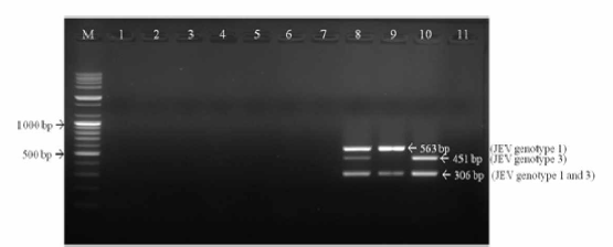 Specificity of differential JEV RT-PCR using three kinds of primer sets. The RT-PCR detected only genotype of JEV and did not have positive signal for any other viral pathogens. M； lOObp DNA ladder, lane 1； classical swine fever virus, lane 2； porcine parvovirus, lane 3； encephalomyocarditis virus, lane 4； Aujezsky’ s disease virus, lane 5； transmissible gastroenteritis virus, lane 6； porcine epidemic diarrhea virus, lane 7； porcine reproductive and respiratory syndrome virus, lane 8； JEV G1 and 3, lane 9； JEV Gl, lane 10; JEV G3, lane 11； distilled water (negative control)