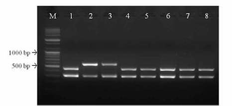 Application o f multiplex RT-PCR to commercial JE vaccines. Five JE vaccines and one Korean field strain (K95) showed positive reactions in the multiplex RT-PCR kit. M； lOObp DNA ladder, lane 1； Anyang 300 strain, lane 2； KV1899 strain, lane 3； K95 strain, lane 4； Greencross® Porcine JE, lane 5； Daesung JE pig vac, lane 6； Suishot® JE, lane 7； Provac® JE, lane 8； Himmvac® JE